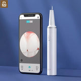 SUNUO Visual Electric Ultrasonic Dental Whitener Scaler Teeth Calculus Tartar Remover Smart App 500W HD Endoscope Cleaner Tooth