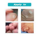 12PCS  Medical Plaster Foot Corn Removal Warts Thorn patches  Corn of foot Calluses Callosity Detox clavus  Medical Patch