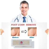 12PCS  Medical Plaster Foot Corn Removal Warts Thorn patches  Corn of foot Calluses Callosity Detox clavus  Medical Patch